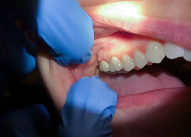Best Weekend Emergency Dentist in Staples, MN